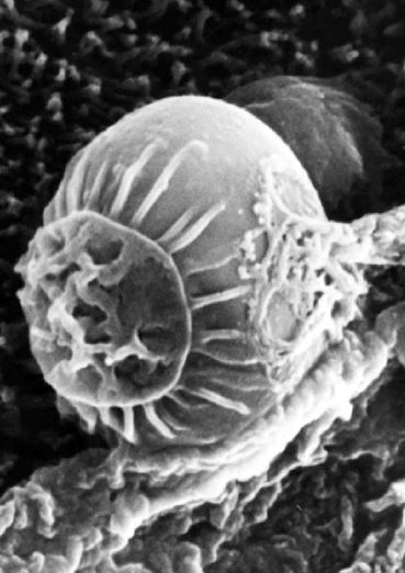  microscopic image of Cryptosporidium